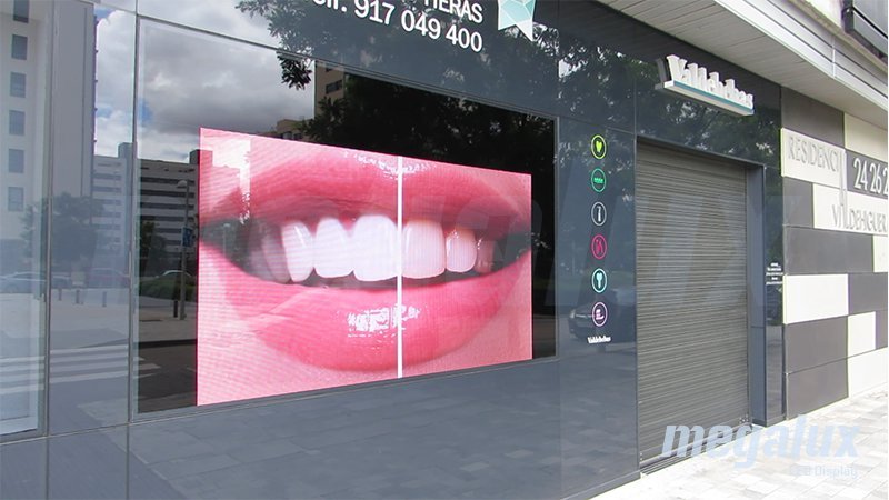 Clínica Dental Valdebebas elige a Megalux Display para su nueva pantalla LED